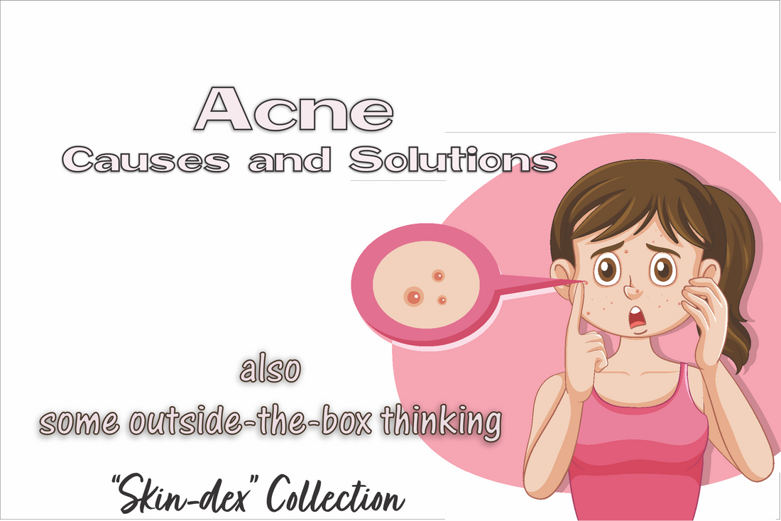 Bacterial acne, what causes it and how to manage it.