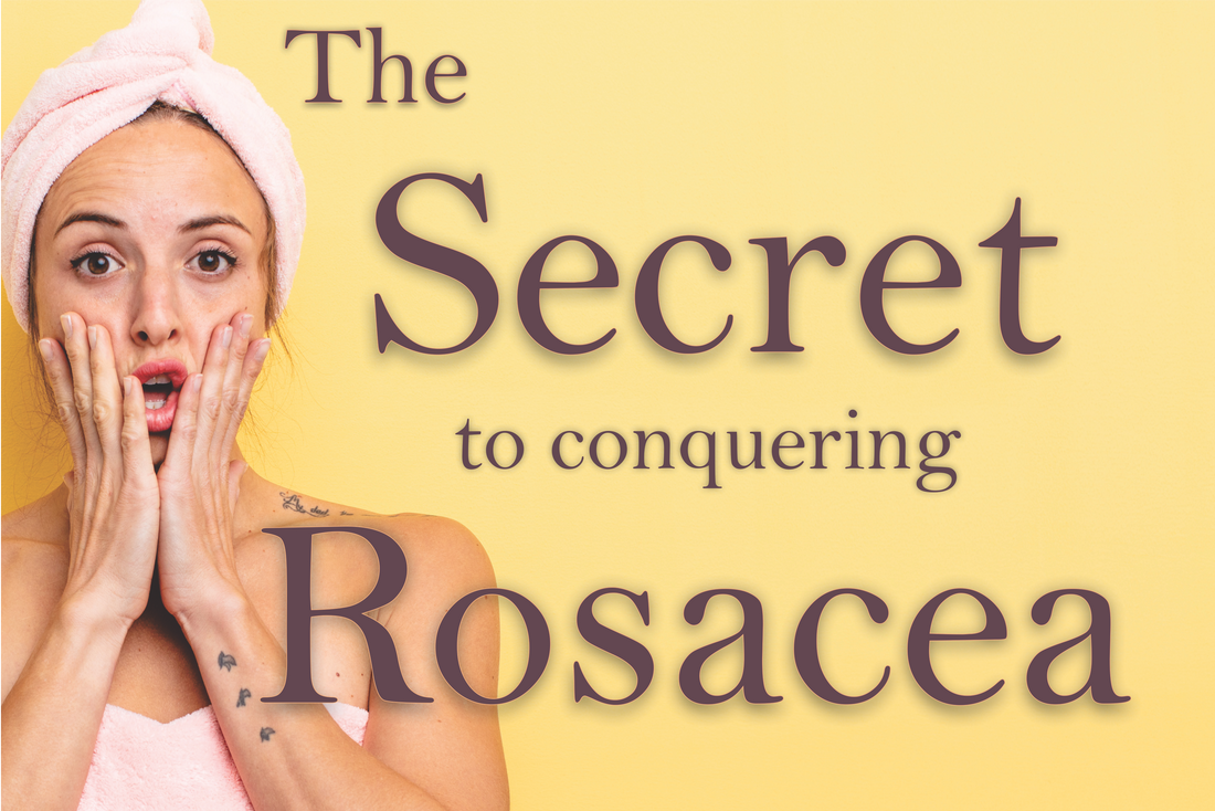 Laser treatments for rosacea and redness.